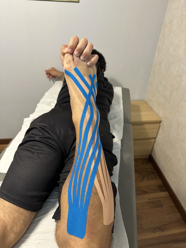 tape neuromuscolare a Cormano