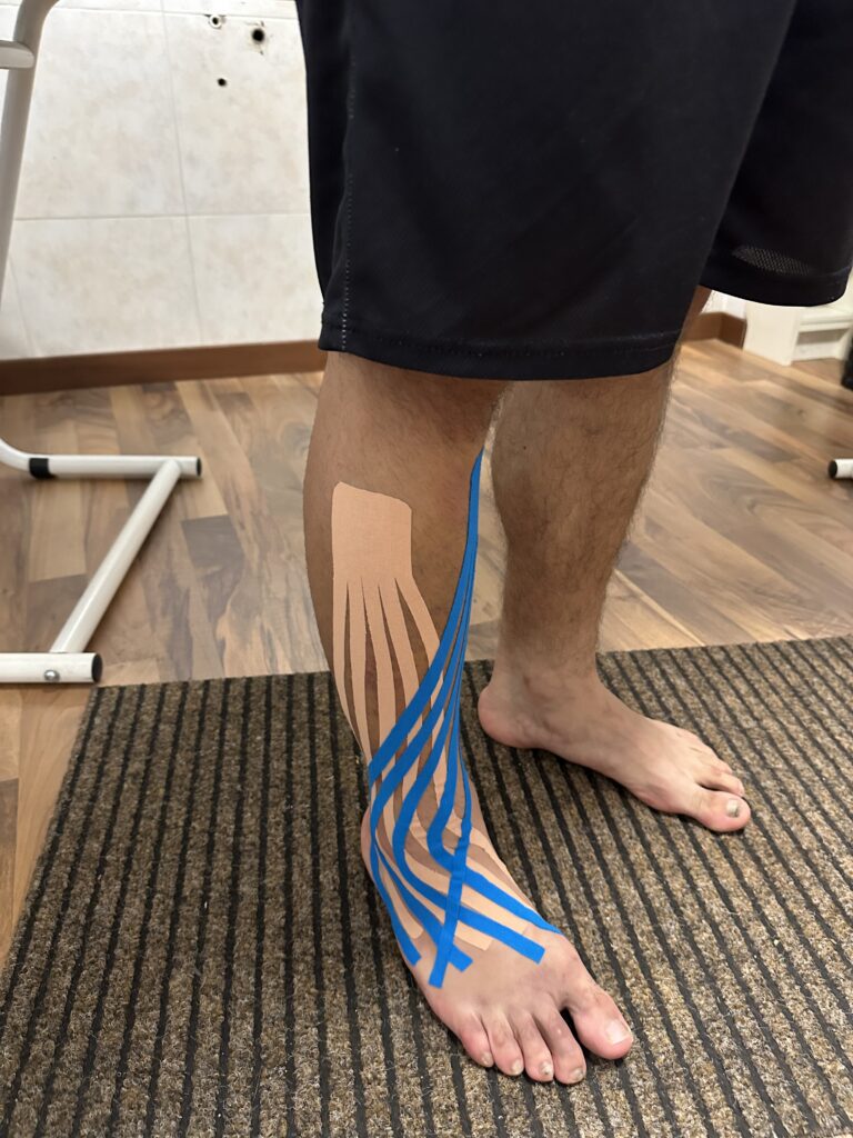 Applicazione tape neuro muscolare post distorsione di caviglia