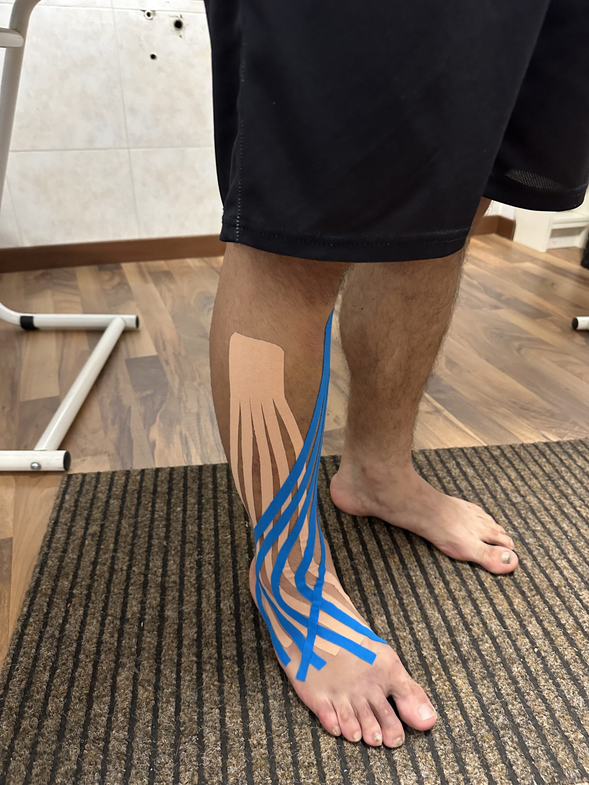 Applicazione tape neuro muscolare post distorsione di caviglia